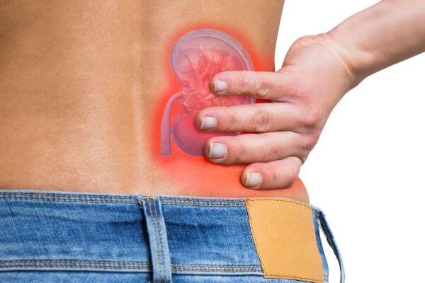 Insuficiencia Renal